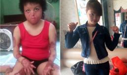 Giây phút khủng khiếp người vợ trẻ đẹp bị chồng tẩm xăng thiêu sống