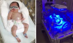 Con trai mới sinh của Lý Hải có chỉ số vàng da hơi cao