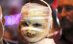 Cập nhật tin tức thế giới 7 ngày qua bằng ảnh (10 - 17/7)