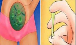 8 dấu hiệu vùng kín không khỏe và 11 điều nên làm trước khi quá muộn