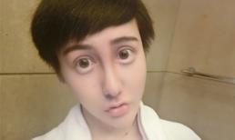 Đôi mắt lộ quầng to và ngày càng thâm đáng sợ của chàng trai 'xà quái'