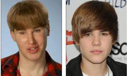 Hé lộ lý do tử vong của ngôi sao phẫu thuật giống Justin Bieber