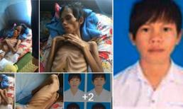 Chàng trai 17 tuổi ở Kon Tum bị đâm vì ghen tuông đã bất ngờ qua đời!