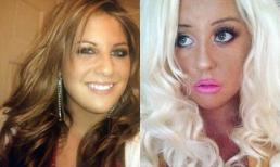 Cô gái chi hơn 400 triệu đồng 1 năm phẫu thuật trở thành búp bê Barbie