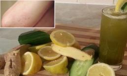 Mẩn ngứa, dị ứng sẽ hết bay với 1 ly nước chanh, gừng, dưa leo