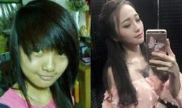 Khoe ảnh 'lột xác', cô nàng bị vu 'bán vốn tự có' để phẫu thuật thẩm mỹ