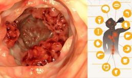 5 tác hại của việc uống rượu mà nhiều người không hề biết