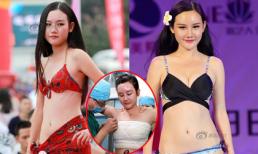 Á hậu bị phanh phui từng phẫu thuật thẩm mỹ