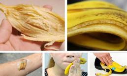 10 tác dụng cực hữu ích từ vỏ chuối mà rất ít người biết