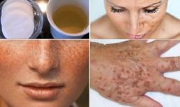 Nếp nhăn, tàn nhang sẽ giảm hẳn nhờ chanh và mùi tây