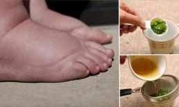 Chữa sưng, phù nề chân chỉ vài ngày với mùi tây