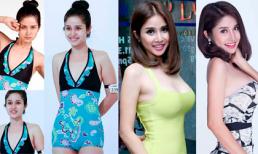 Bác sĩ Hiệp Lợi tư vấn nâng ngực 45 triệu đồng