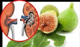 Công thức thần kỳ từ quả sung đánh bay sỏi thận 100% không lo tái phát