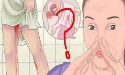Lý giải nguyên nhân vì sao kinh nguyệt có mùi
