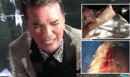 Đàm Vĩnh Hưng bê bết máu ở chân vì trượt ngã vẫn nén đau luyện tập