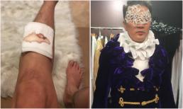 Vết thương của Mr Đàm tứa máu ngay sau đêm liveshow đầu tiên