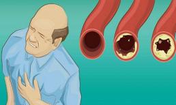 Thực phẩm vàng đặc trị thông tắc động mạch tự nhiên và chống nhồi máu cơ tim