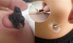 Vệ sinh đúng cách 'nơi bẩn nhất trên cơ thể người' mà thường bị bỏ qua