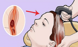 Gội đầu ở bồn tiệm cắt tóc có thể gây đột quỵ