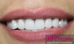 Răng sứ mang màu sắc “trong” như răng thật