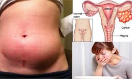 Là phụ nữ không nên bỏ qua những triệu trứng này