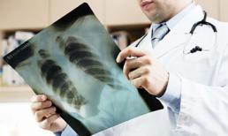 Trung cấp Y TP HCM đào tạo kỹ thuật Siêu âm tổng quát cơ bản 