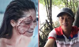 Tin sao Việt mới 15/11: Trương Quỳnh Anh khóc thét khi nhìn gương mặt nát bét, Hoài Linh chụp ảnh sông nước ở Phú Quốc