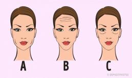 Nhìn khuôn mặt đoán tình trạng sức khỏe cực chuẩn