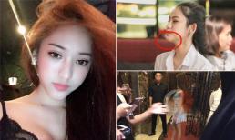 Selfie ảo vậy thôi, đây mới là hình ảnh 'mất cân đối' của Thúy Vi sau khi phẫu thuật thẩm mỹ 