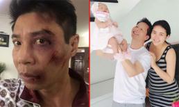 Tin sao Việt mới 29/11: Gương mặt bầm dập đáng sợ của Công Lý, Phan Như Thảo tổ chức đầy tháng cho con gái