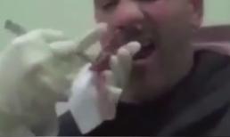 Rợn tóc gáy cảnh lấy con sán dây dài mét rưỡi từ mũi người đàn ông