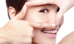 Xóa nhăn đuôi mắt, đánh tan bọng mỡ mắt trong 60 phút