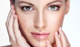 Bí quyết trẻ hóa da “thần thánh” đánh bại thời gian