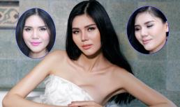 Á hậu Kim Nguyên công khai phẫu thuật thẩm mỹ tại Hiệp Lợi