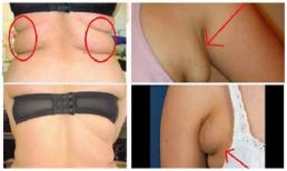 Thoát khỏi tình trạng mỡ thừa ở nách và bụng sau 3 tuần với 4 bài tập đơn giản