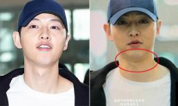 Song Joong Ki 'Hậu duệ mặt trời' lộ mặt tròn trịa vì tăng cân
