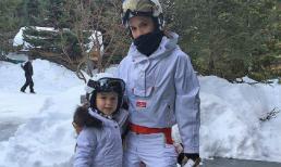 Harper trắng muốt bên mẹ Vic, Brooklyn khoe ảnh phim chụp X-quang xương đòn bị gãy