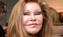 'Thảm họa dao kéo Mỹ' vẫn muốn tiếp tục phẫu thuật làm đẹp cho đến năm 80 tuổi 