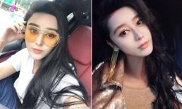  Cô gái mất 8 năm để phẫu thuật giống Phạm Băng Băng