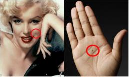 Có nốt ruồi ở 7 vị trí này bạn định sẵn là người giàu sang, may mắn dù muốn hay không