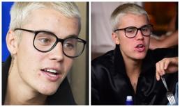 Justin Bieber lộ gương mặt nổi đầy mụn nhọt