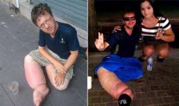 Gã ăn xin người Đức từng bị lật tẩy mánh khóe ở nhiều nước tiếp tục hành nghề tại Sài Gòn