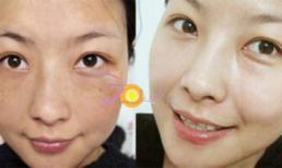 Giải pháp mới 2017 cho người da đen trở nên trắng hồng rực rỡ
