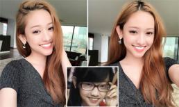 Hot girl Thúy Vi chi hàng trăm triệu để 'thẩm mỹ' răng