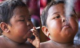 Cậu bé 2 tuổi hút 40 điếu thuốc mỗi ngày khiến thế giới phải sốc giờ ra sao?