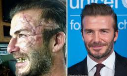 Choáng váng gương mặt đầy sẹo và hàm răng vàng ố của David Beckham 