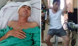 Hơn 8 tháng ghép hộp sọ thành công, diễn viên Nguyễn Hoàng giờ ra sao?