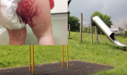 Bàng hoàng khi thấy chân con mình đầm đìa máu, thủ phạm là thứ công viên nào cũng có...