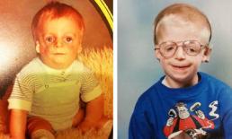 Bỏ rơi con mới sinh vì quá xấu xí, cha mẹ chắc chắn không ngờ con có ngày này