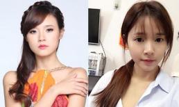 Midu lên tiếng khi bị nghi phẫu thuật thẩm mỹ